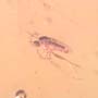 Rare Swarm Of Gall Midges, Barklouse And Beetle In Dominican Amber.