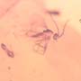 Rare Swarm Of Gall Midges, Barklouse And Beetle In Dominican Amber.