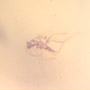 Rare Swarm Of Gall Midges And Four Eggs In Dominican Amber.