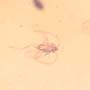 Rare Swarm Of Gall Midges And Moth Fly In Dominican Amber.