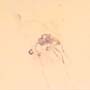 Rare Swarm Of Gall Midges And Moth Fly In Dominican Amber.