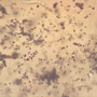 Rare Swarm Of Larva In Dominican Amber.