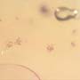 Rare Swarm Of Mite In Dominican Amber.