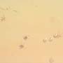 Rare Swarm Of Mite In Dominican Amber.