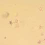 Rare Swarm Of Mite In Dominican Amber.
