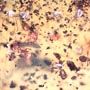 Rare Swarm Of Worker Ant In Dominican Amber