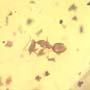 Rare Moth Fly With Six Eggs And Worker Ant In Dominican Amber