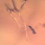 Rare Worker Ant With Fairy Fly Clinging On Its Leg In Dominican Amber