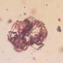 Rare Fighting Of Worker Ants In Dominican Amber