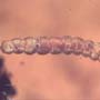 Rare Isopod And Larva In Dominican Amber