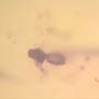 Rare Jumping Plant Lice In Dominican Amber
