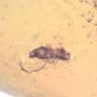 Rare Jumping Plant Lice In Dominican Amber