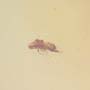 Rare Jumping Plant Lice In Dominican Amber